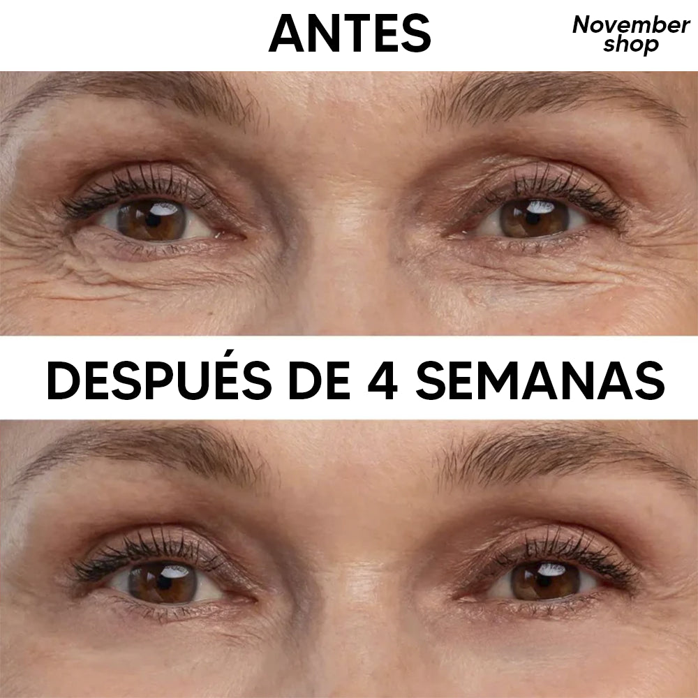 eelHope® Contorno de Ojos Rejuvenecedor
