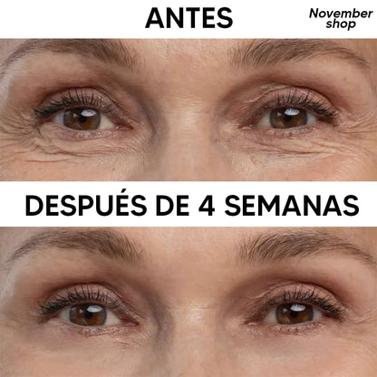 eelHope® Contorno de Ojos Rejuvenecedor