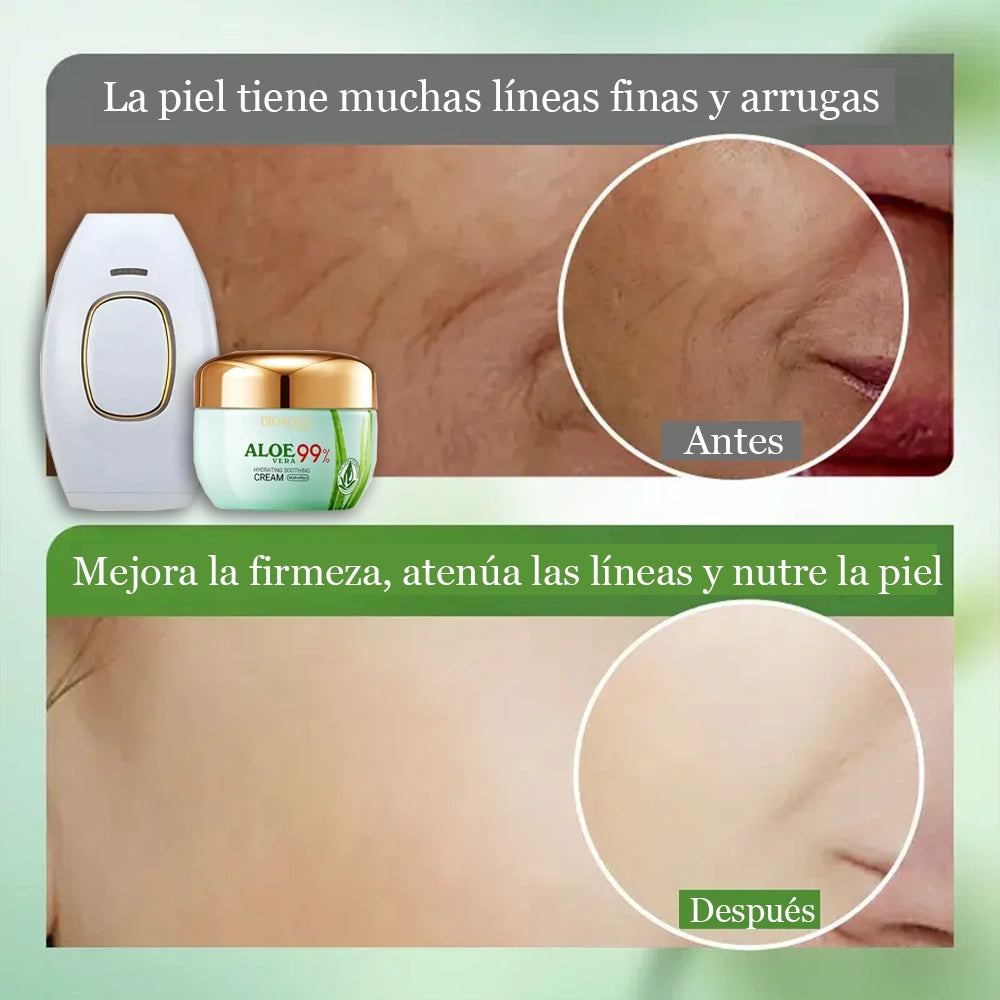DEPILADORA LASER IPL® + CREMA HIDRATANTE AV GRATIS
