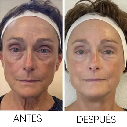 Crema CELYN® - Para Ojeras, Párpados y Arrugas