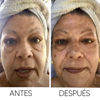 Crema CELYN® - Para Ojeras, Párpados y Arrugas