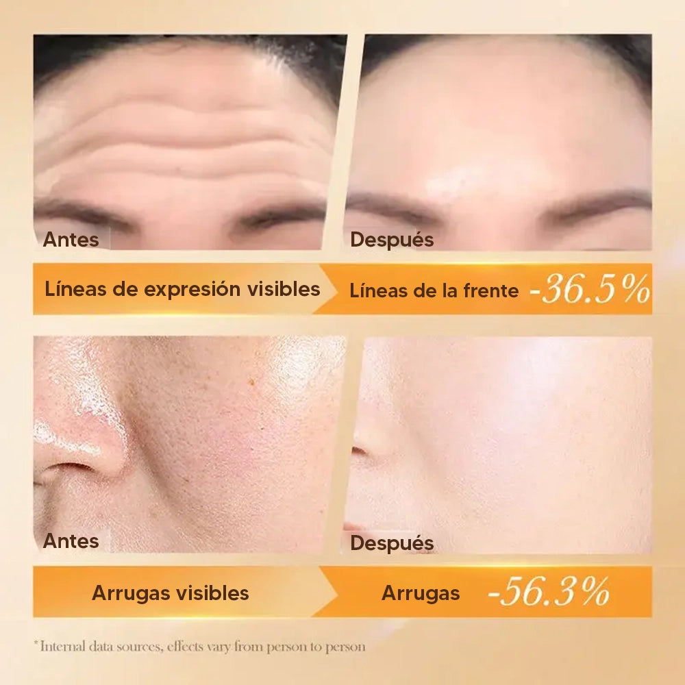 Crema Antivejecimiento NSRetinol®
