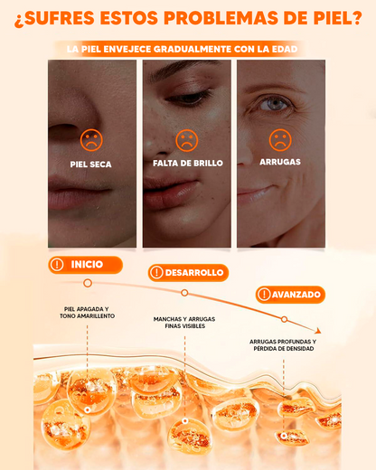 SADOER® Crema Blanqueadora 5 en 1 con Vitamina C + Niacinamida