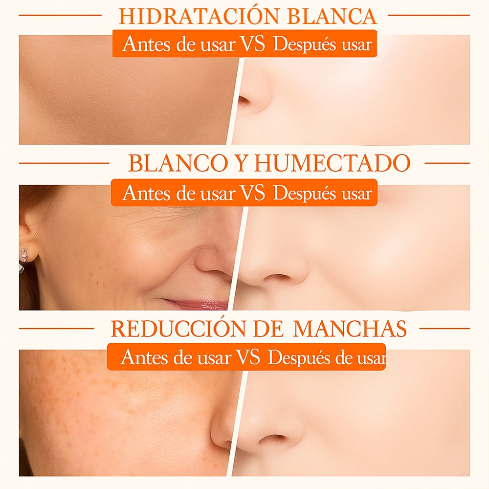 SADOER® Crema Blanqueadora 5 en 1 con Vitamina C + Niacinamida