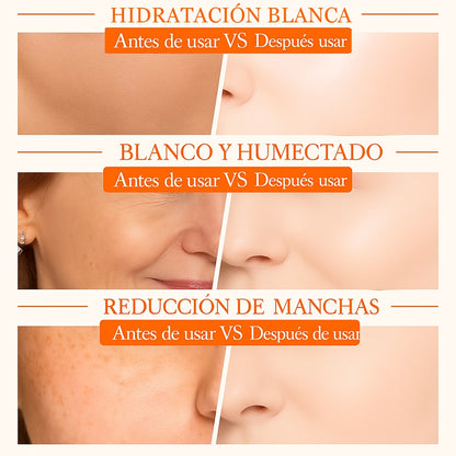 SADOER® Crema Blanqueadora 5 en 1 con Vitamina C + Niacinamida